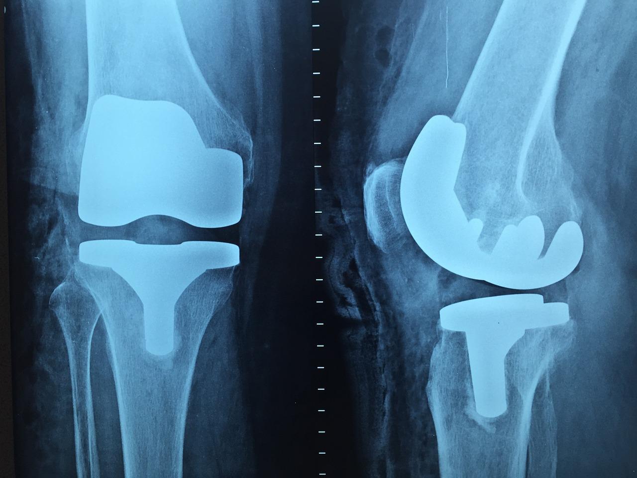 Orthopedie in Rotterdam