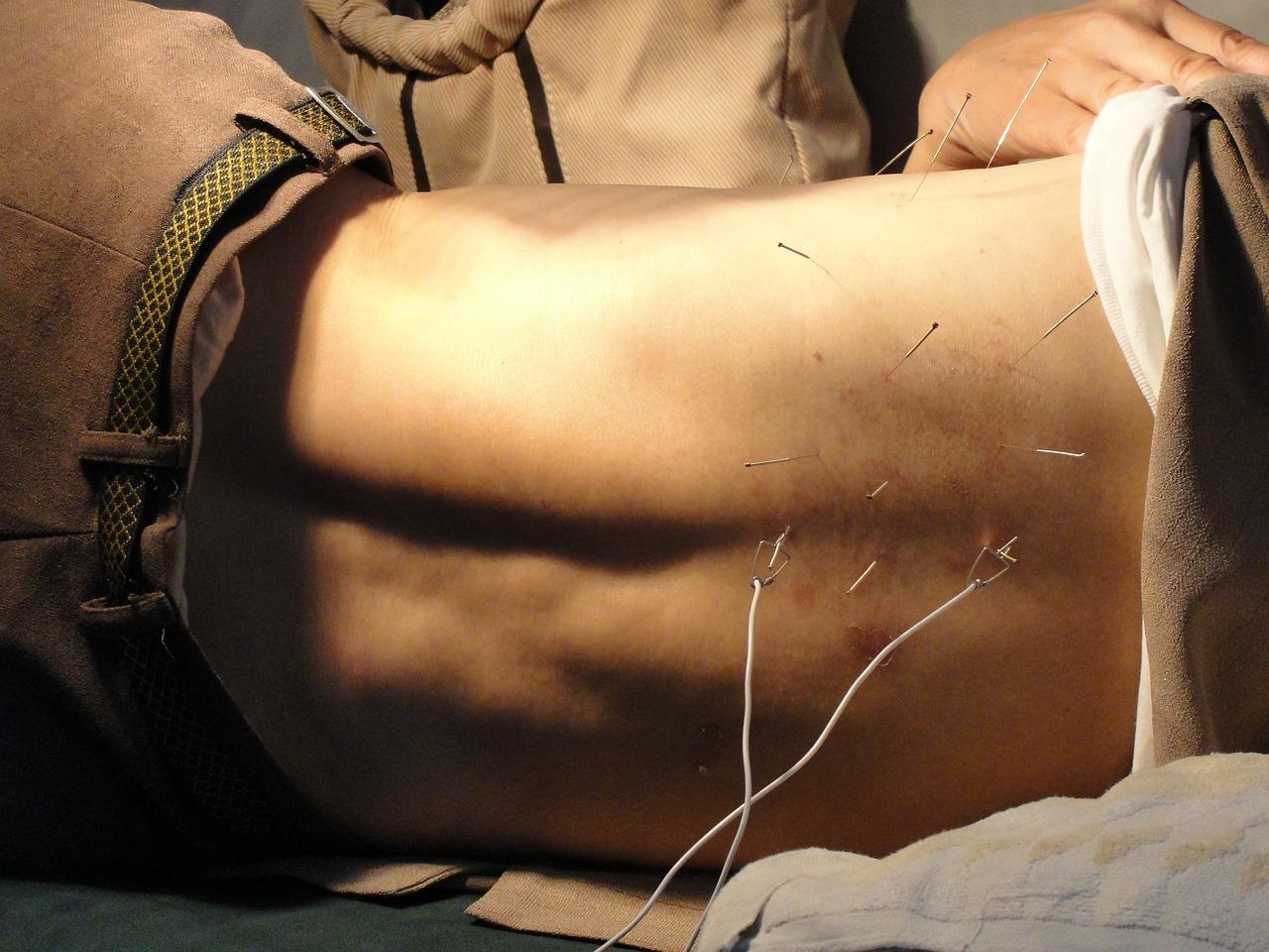 Acupuncturist in Rotterdam